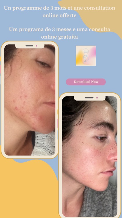 FREE ACNE screenshot-5