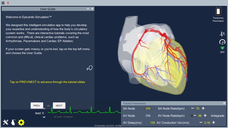 Temporary Cardiac Pacing screenshot-5