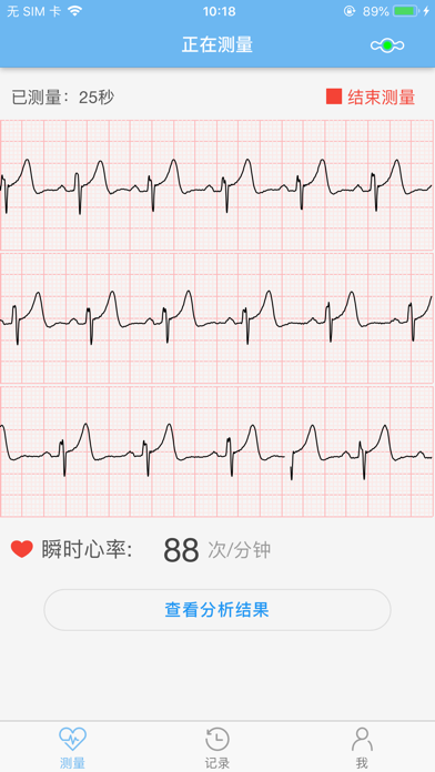 数维康心电 screenshot 3