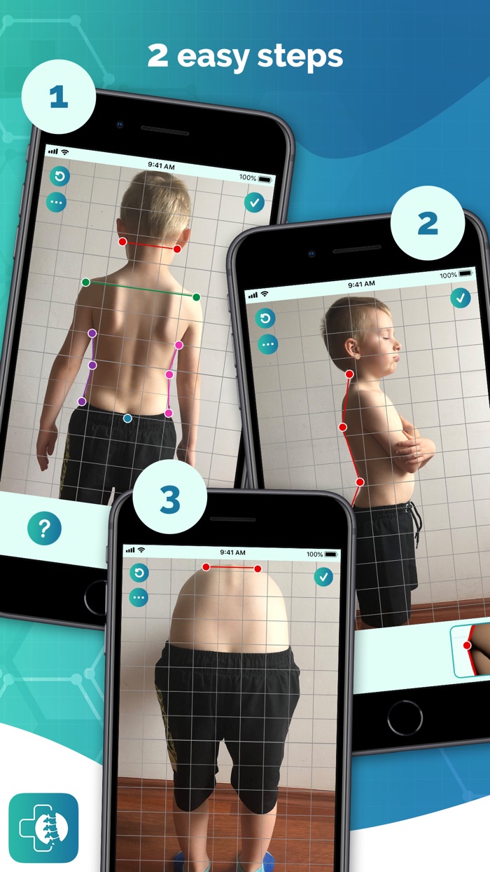 Healthy Back Posture Analysis