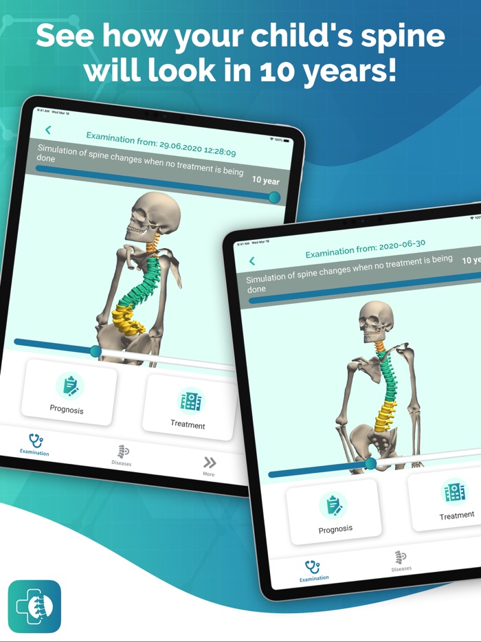 Healthy Back Posture Analysis