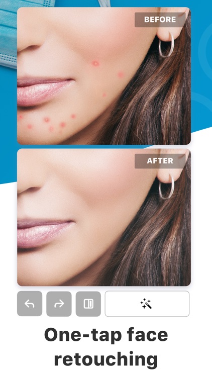 Blemish Editor - Face Tuner