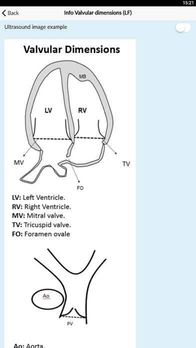 Fetal BCN Calculator screenshot 3