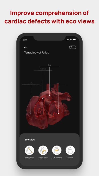 Congenital heARts screenshot-5