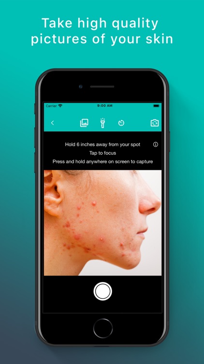 Skin App - Online Dermatology by MetaOptima Technology Inc.