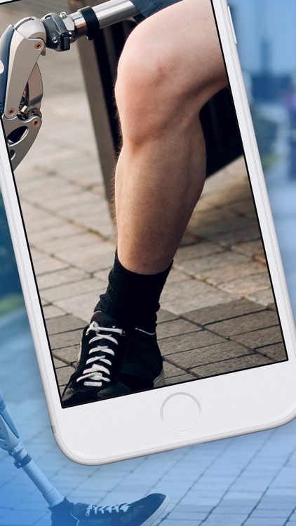 Mirror Box: CRPS & RSD, Stroke