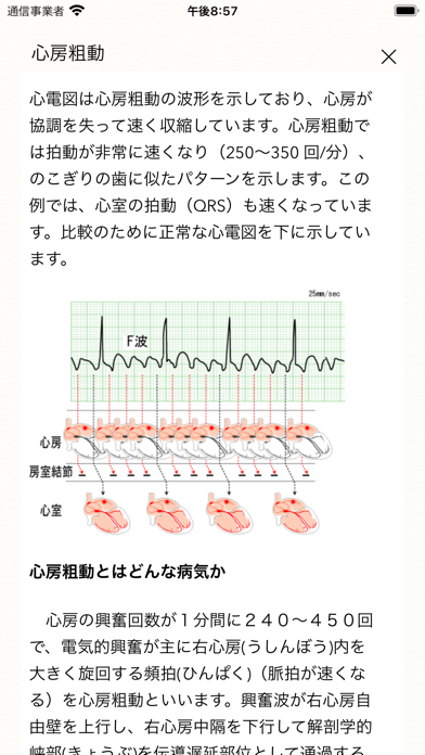 心電図ブック Ecg Ekg Books Iphoneアプリ Applion
