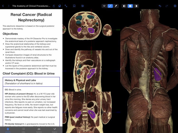 VH Dissector Pro screenshot-5