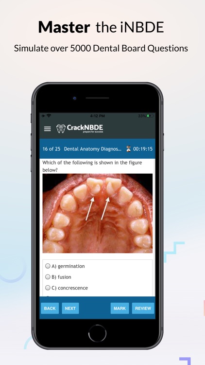 Crack NBDE Dental Boards Prep