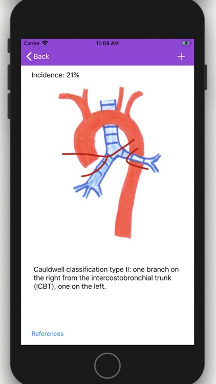 Vascular Variants screenshot-6