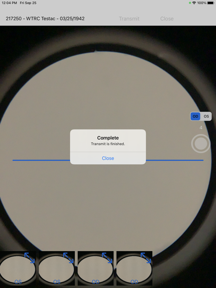 Brane SlitLamp Capture