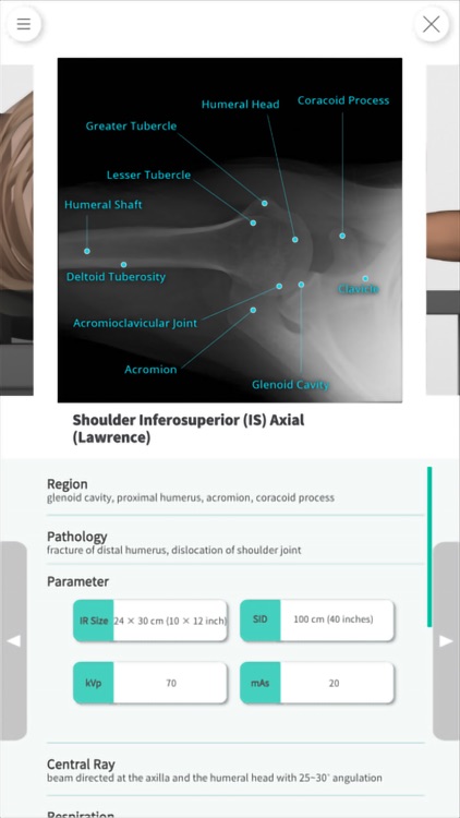 Navi Radiography Lite screenshot-5