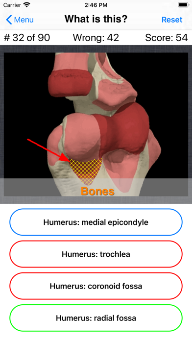 Anatomy Hand Quiz Screenshot 7