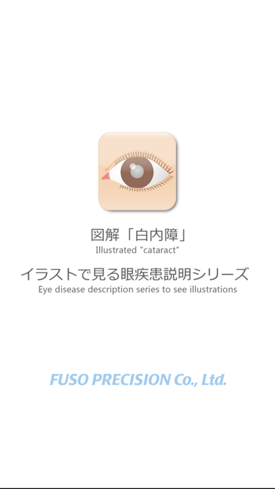 図解 白内障 イラストで見る眼疾患説明シリーズ Iphoneアプリ Applion 図解 白内障 イラストで見る眼疾患説明シリーズ Iphoneアプリ Applion