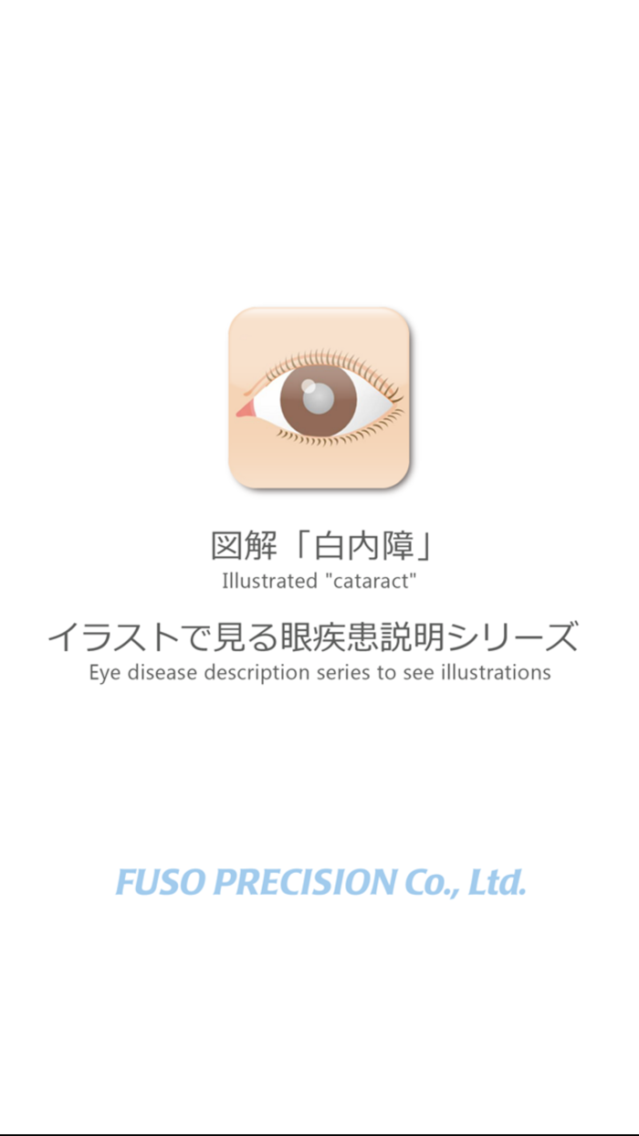 図解「白内障」イラストで見る眼疾患説明シリーズ