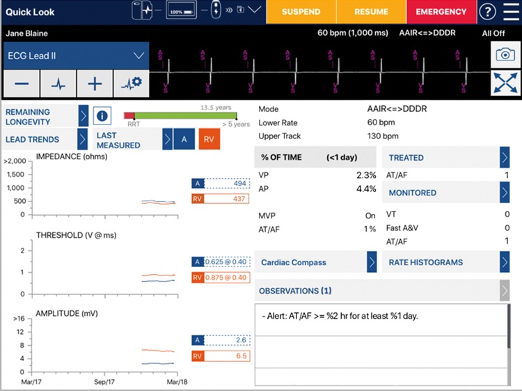 carelink-smartsync-carib-by-medtronic-inc
