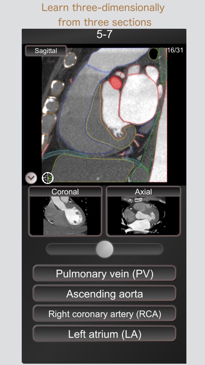 CT PassQuiz Heart / MRI