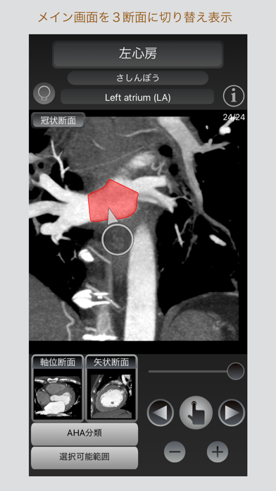 Ct Passport 心臓 Heart Mri Iphoneアプリ Applion