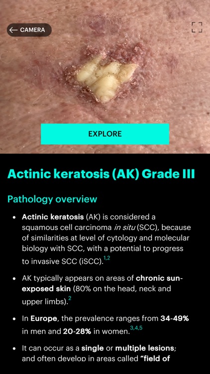 Actinic Keratosis AR