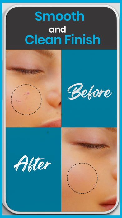 Pimple Remover + screenshot 3