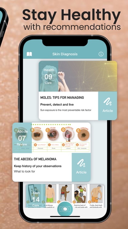 Skin Checker For Your Mole