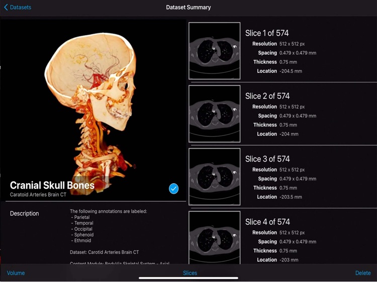 BodyViz