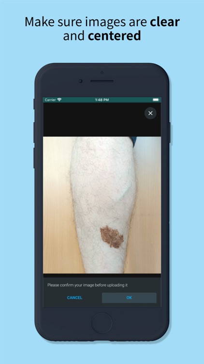 Skin Check: Dermatology App screenshot-3