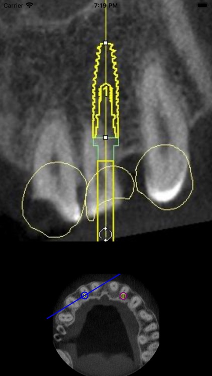 Dental CT View screenshot-7