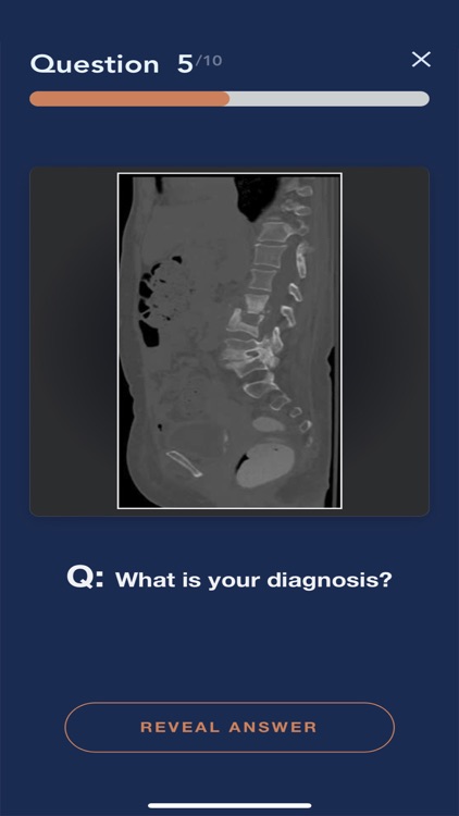 CTisus L-Spine Pathology screenshot-4