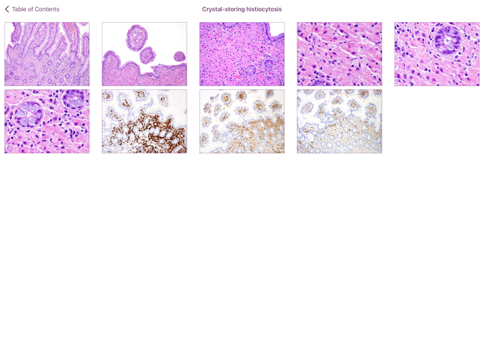 Small Intestinal Pathology