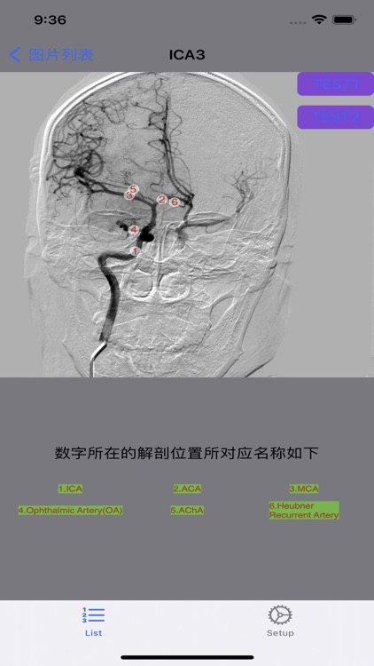 脑血管学习 screenshot-6