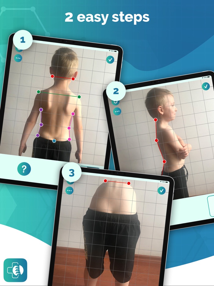 Healthy Back Posture Analysis
