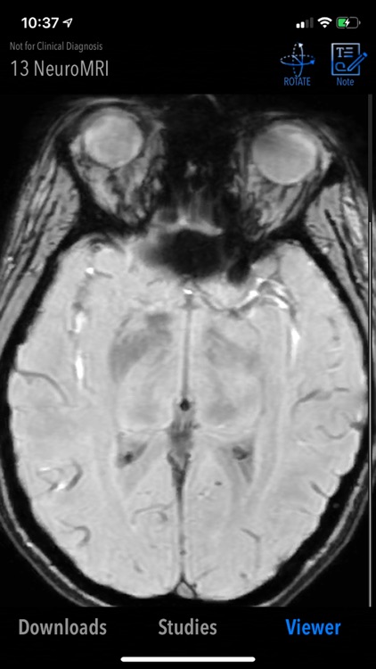 MedVizi™ CT-MRI Viewer screenshot-3