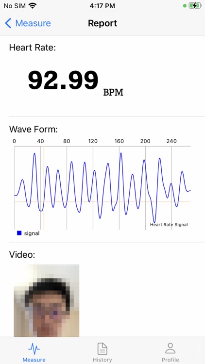 Remote Vital Signs