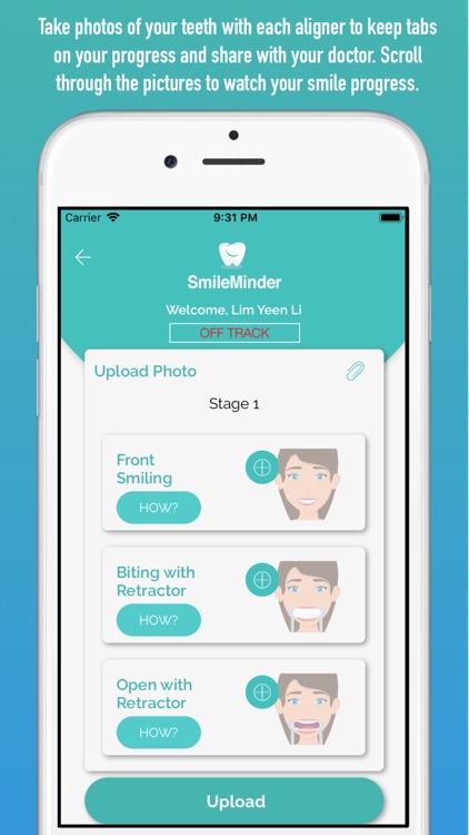 SmileMinder