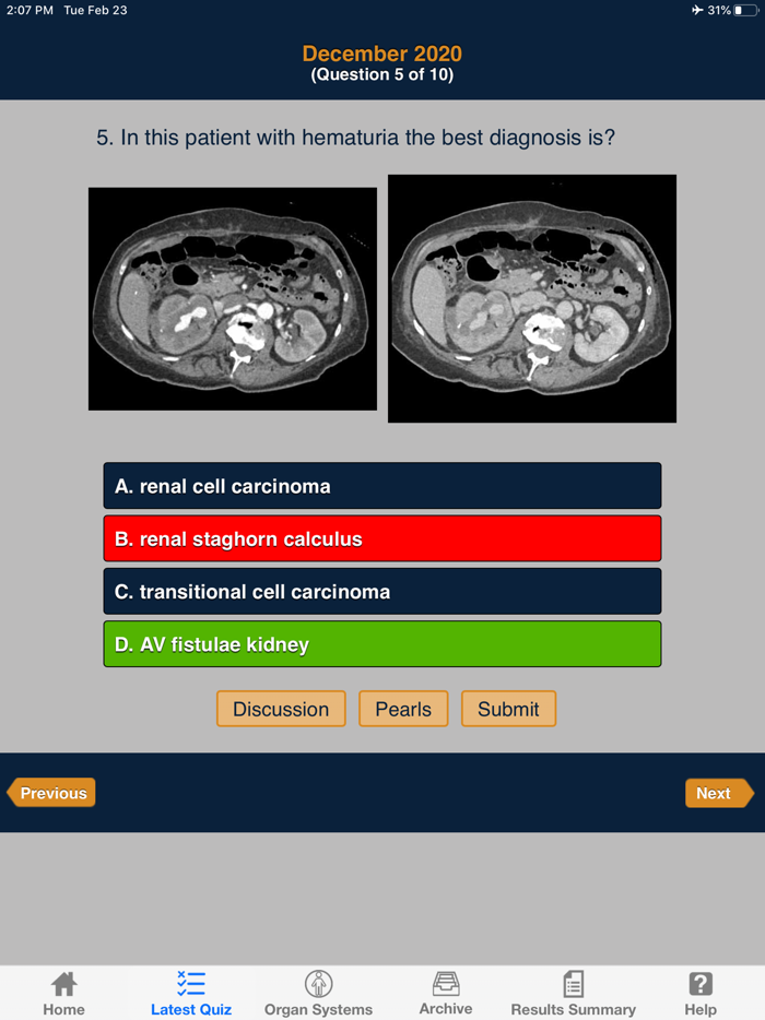 CTisus iQuiz The HD Edition