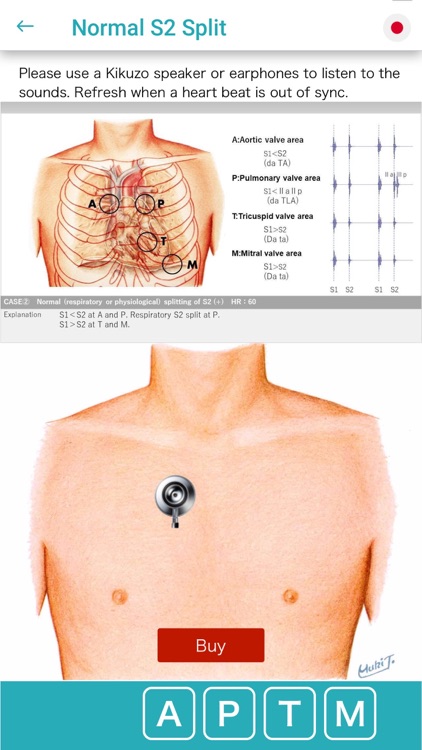 Ausculaide