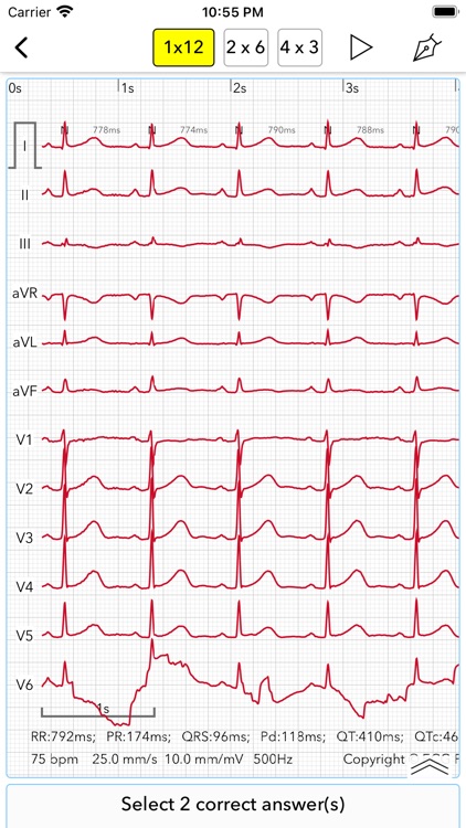 ECG Test Pro screenshot-8