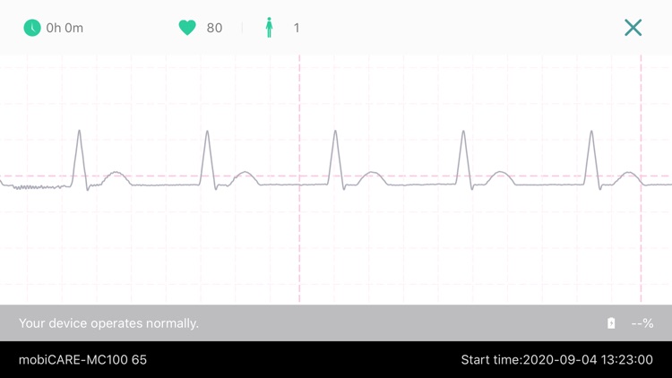 mobiCARE Cardio