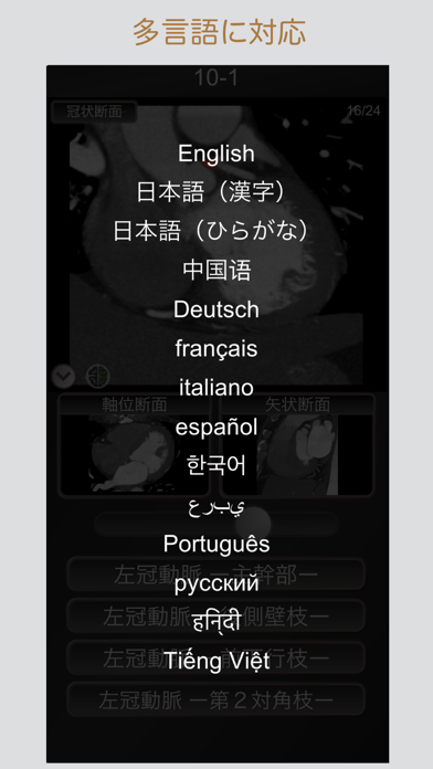 CT PassQuiz 心臓 / MRI screenshot1