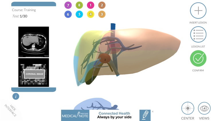 LIVER-NOTE.Edu