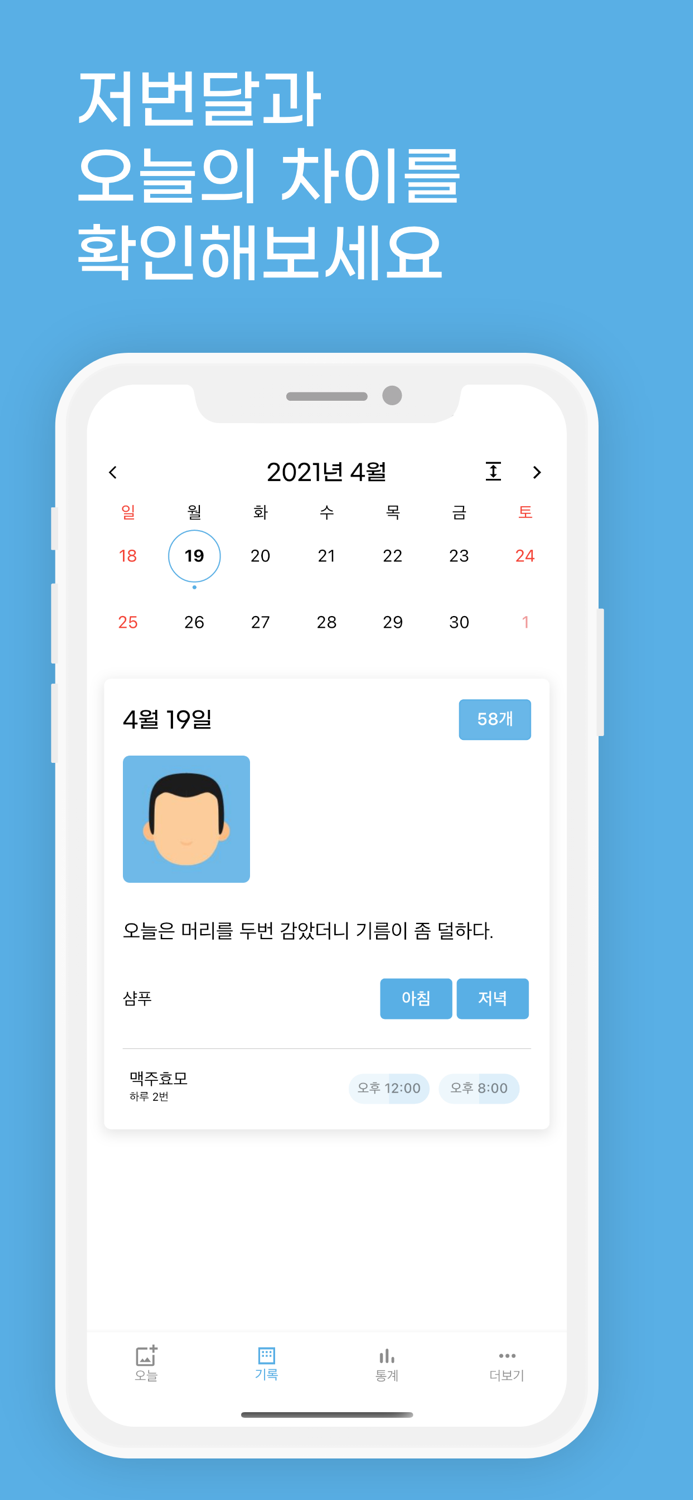 위풍당당 - 머리 사진 기록 탈모 기록