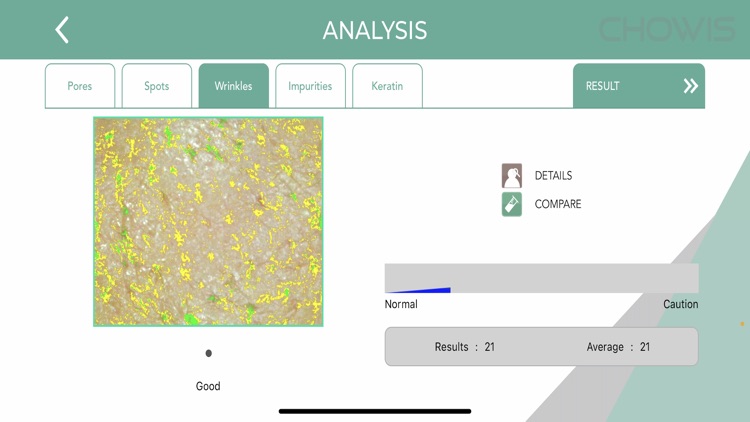 Chowis Skin Analyzer 2 screenshot-4