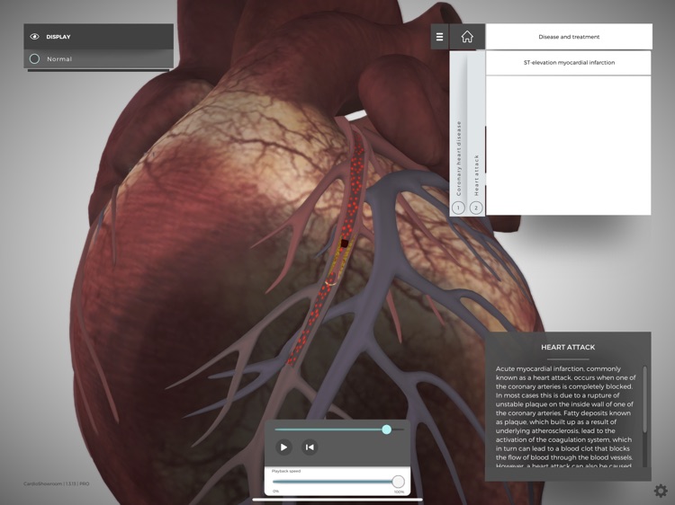 CardioShowroom (CSR) screenshot-3