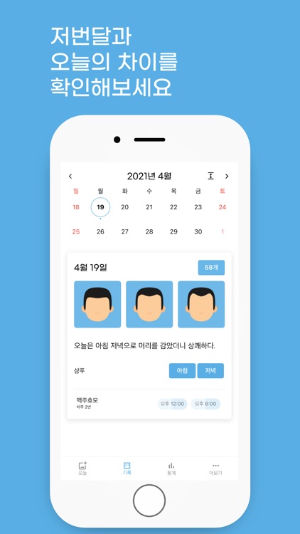 위풍당당 - 머리 사진 기록 탈모 기록