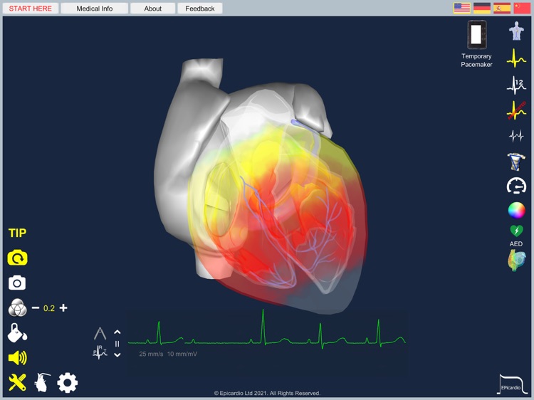 Epicardio Heart Simulator screenshot-6