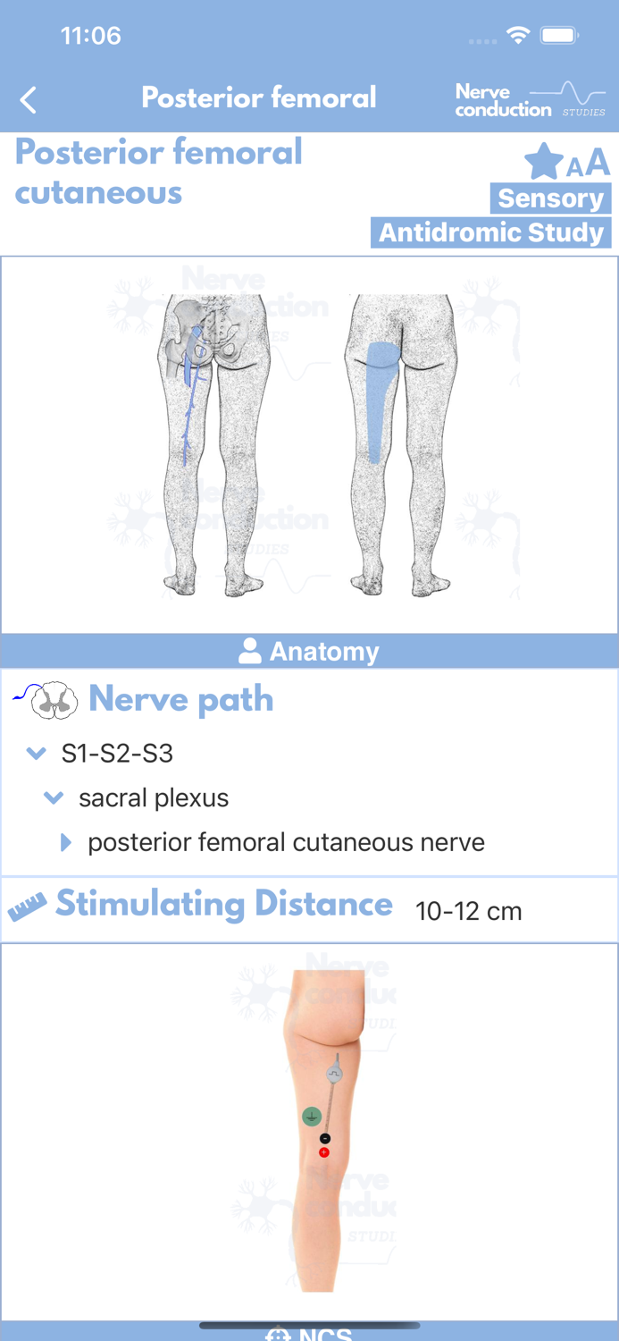 Nerve Conduction Studies