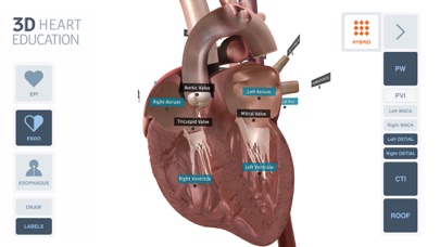 How to cancel & delete ACT 3D Heart from iphone & ipad 2