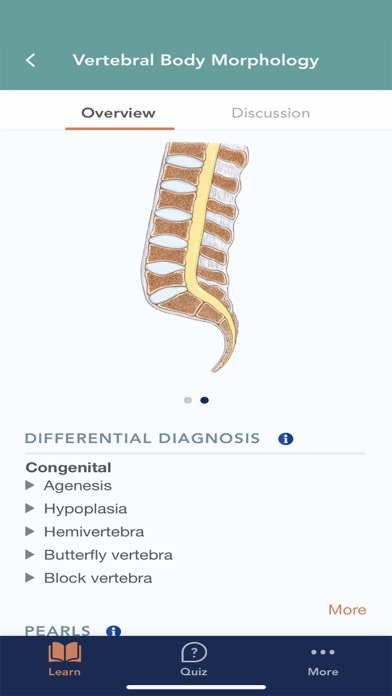 CTisus L-Spine Pathology screenshot 3