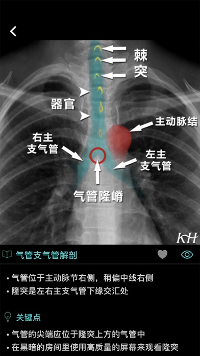 影像图谱